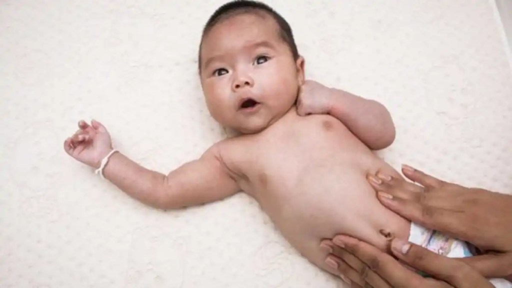 Perut Kembung Bikin Bayi Rewel? Coba Tips&nbsp;Ini!